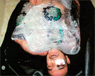 A dead prisoner's body wrappedin cellophane and packed in ice