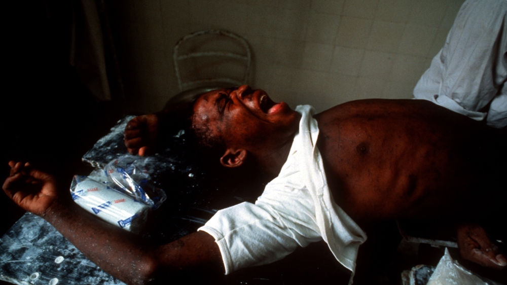 An Angolan man has his leg amputated without anesthetic at a hospital in Quito. He had stepped on a landmine. His anguish pervaded me. 1993 [Jack Picone]