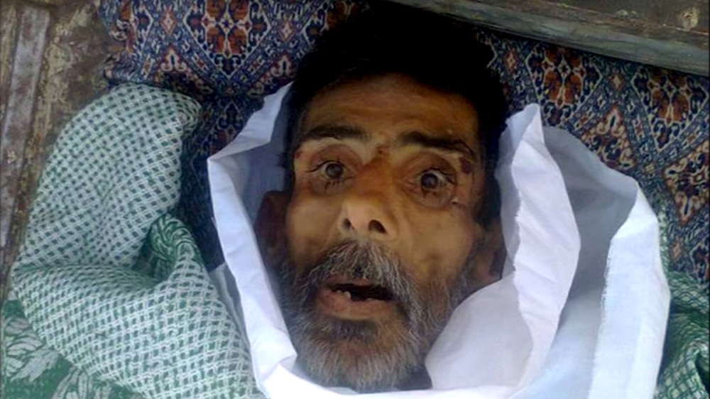 Madaya starvation Syria