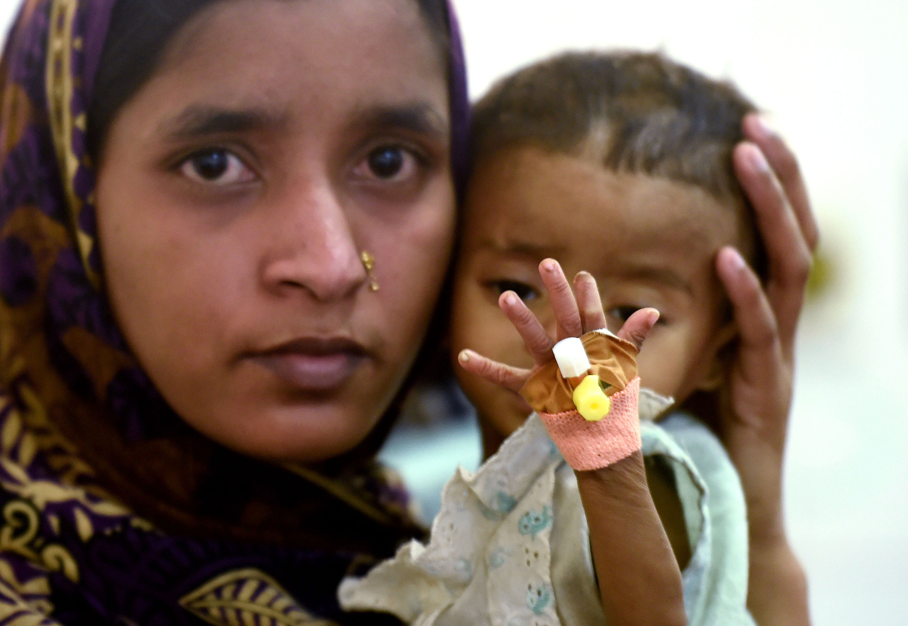 Bangladesh Heart surgery /Please Do Not Use