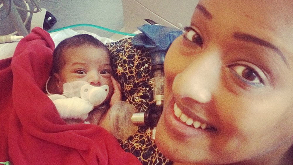 
'For a long time, I was afraid of touching her. Doctors had warned me not to lift her from beneath her arms for at least three months' [Fatma Naib photo]
