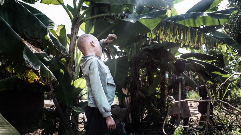 Semuju catches some shade under a banana tree [Fredrik Lerneryd/Al Jazeera]