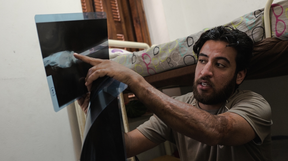 Akram al-Majidi was wounded in a car bombing that targeted his shop in Baghdad [Nick Paleologos/SOOC/Al Jazeera] 