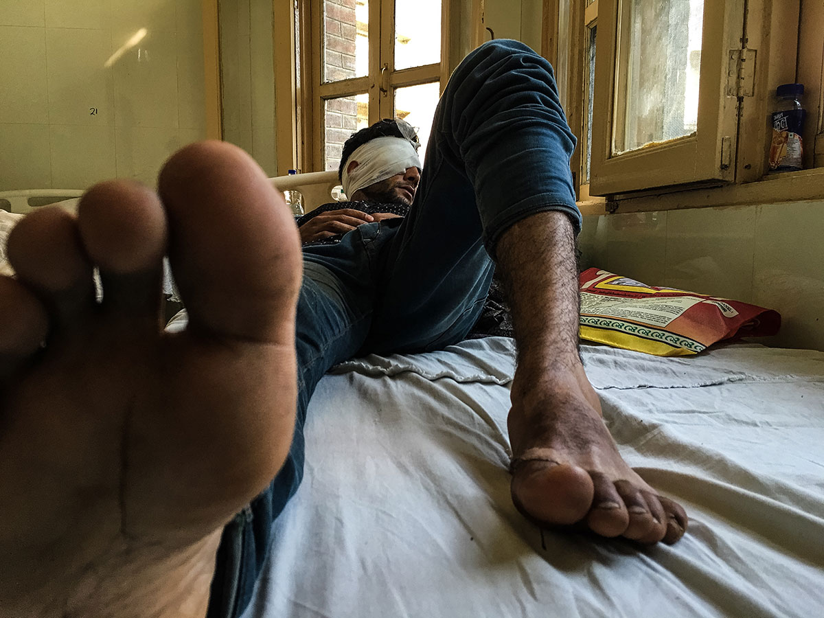 Pellet Injuries/ Please Do Not Use