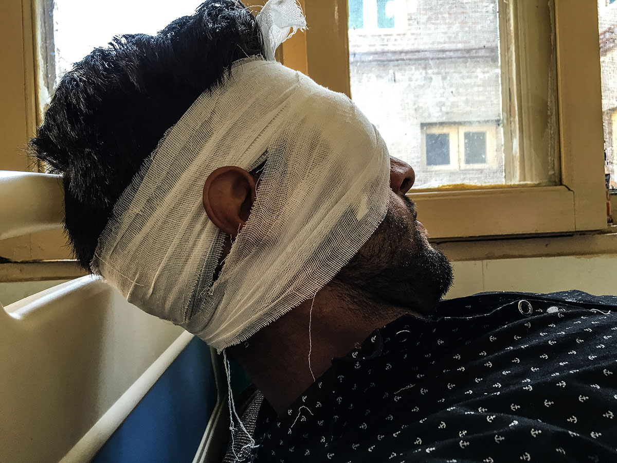 Pellet Injuries/ Please Do Not Use  