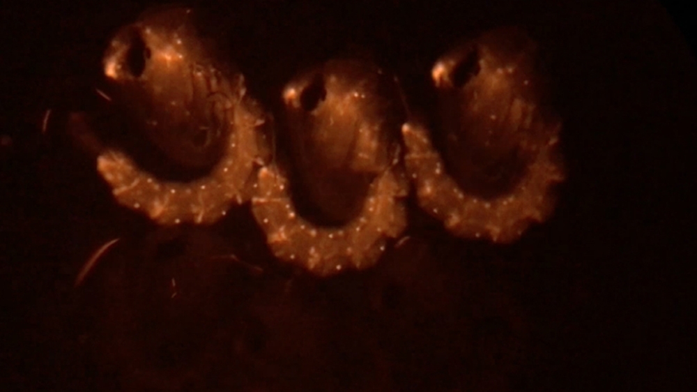 Under a special microscope, the genetically modified mosquitoes light up [Al Jazeera]