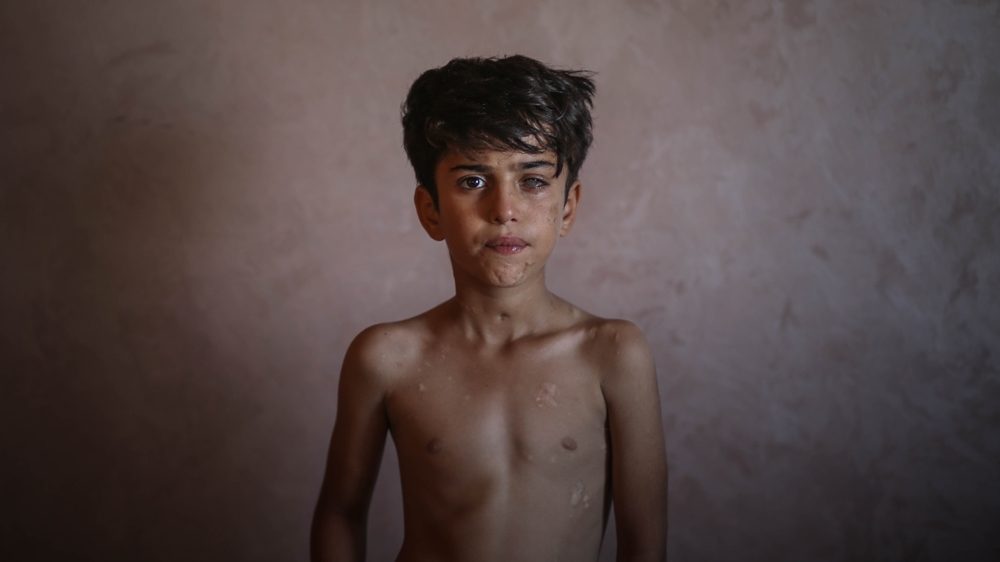 Amir was six when the third Israeli war on Gaza started in 2014 [Ezz Zanoun/Al Jazeera]