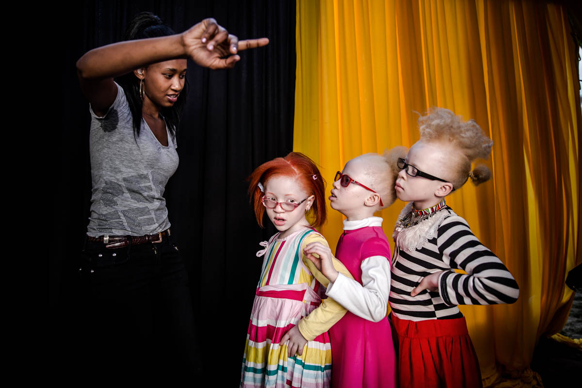 East Africa albino beauty pageant aims to fight social stigma