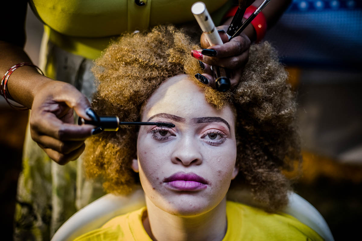 East Africa albino beauty pageant aims to fight social stigma