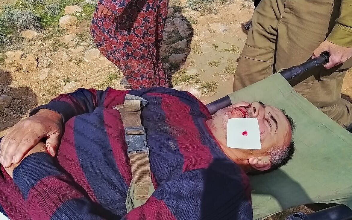 Saeed Awad lays motionless after being attacked by settlers as Israeli army solders carry him on a stretcher [Courtesy: B'Tselem]