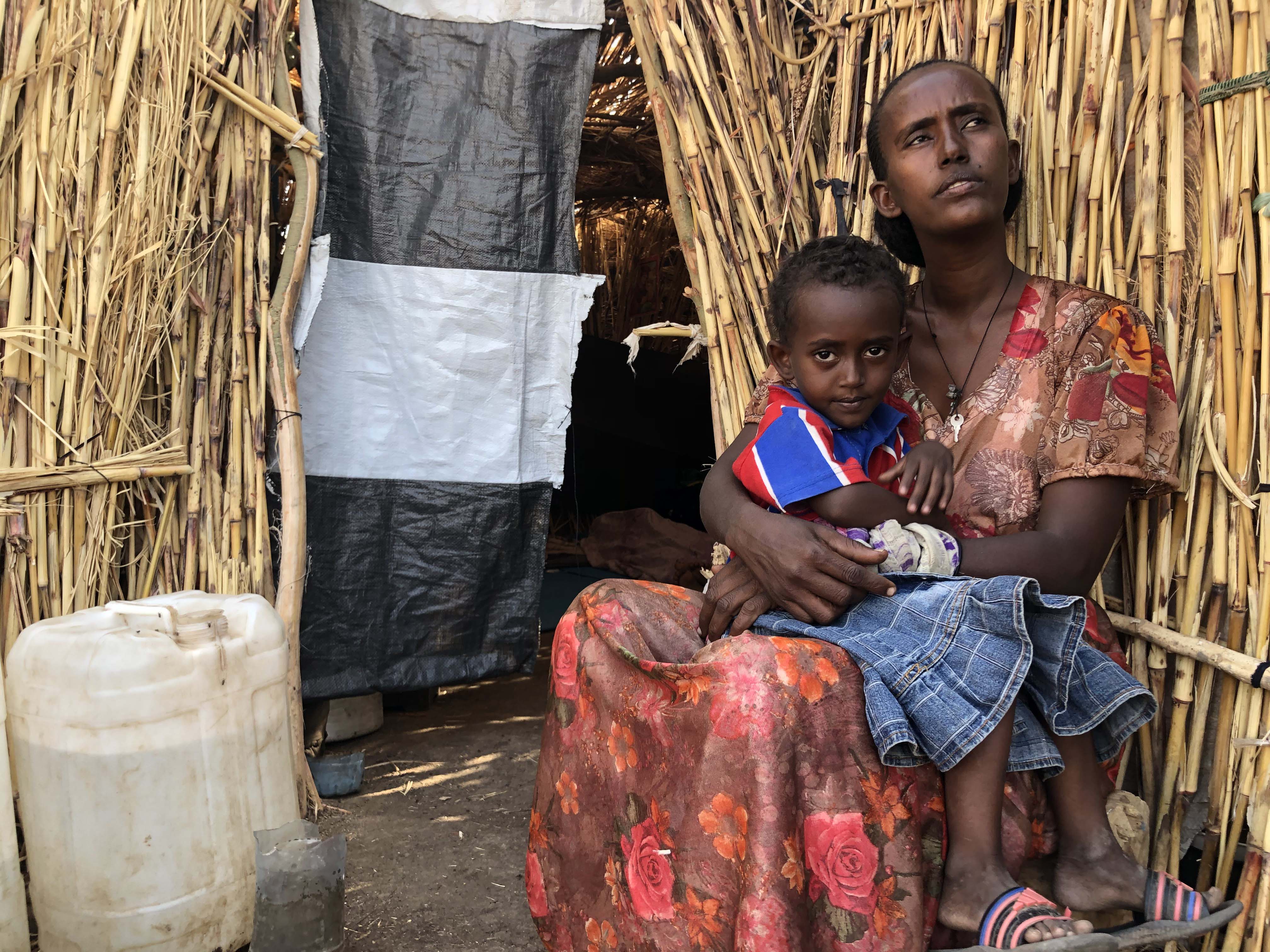 Tsgay, a 35-year-old Ethiopian woman and her four-year-old daughter Dalina, who fled Ethiopia's Tigray region, sit in the Hamdayet Reception Area on the Sudanese side of the border on February 14, 2021 [Courtesy of MSF] She shared with MSF teams: “The food that we eat doesn’t contain any nutrients, but we have no option, we have to eat it in order to survive.” “When we fled from Tigray we had some money. We used to buy sorghum from the market. Now we spent [all our money]. Now we are forced to take the wet portage and mix it with the little amount of flour we have and use it to make injera.”