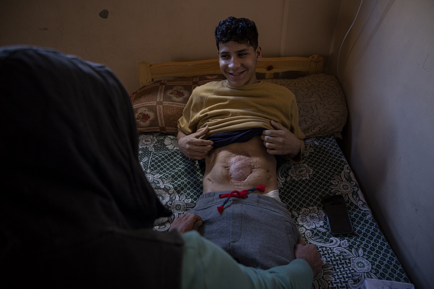 Mahmoud Naim, 18, lies on his bed after he was paralyzed when a shrapnel pierced his back. 