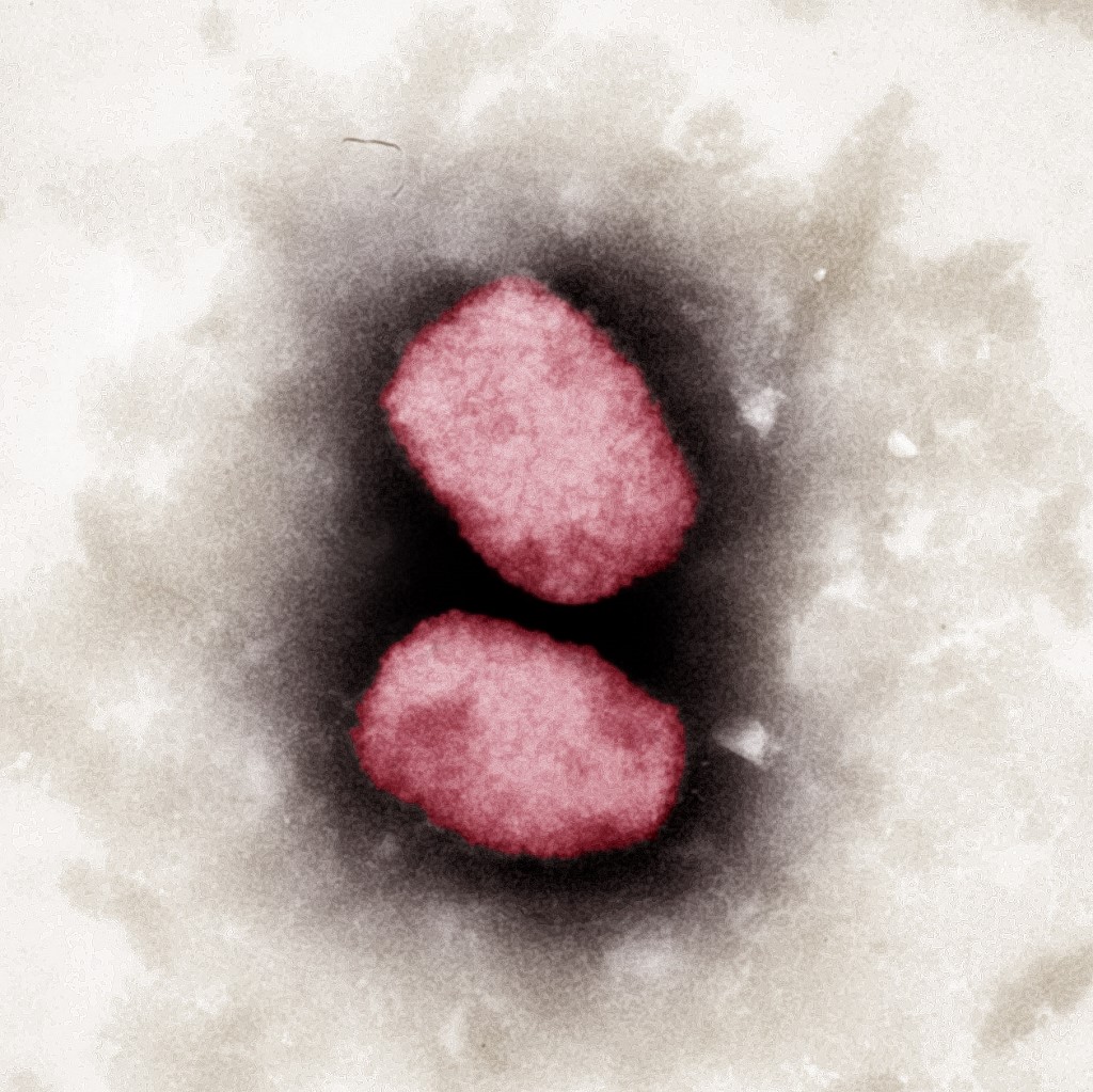 Colored electron-microscopic capture of the monkeypox virus