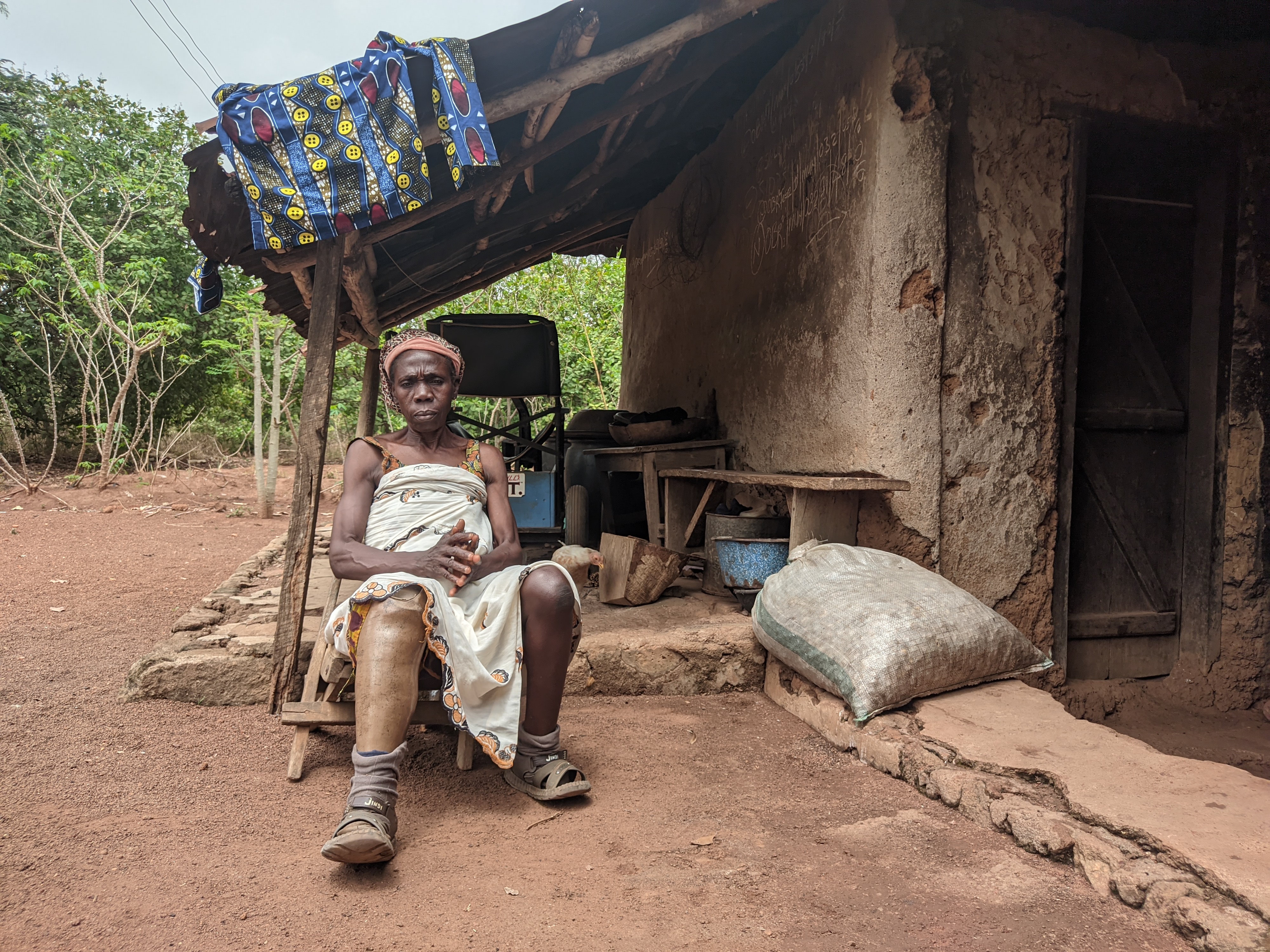Abigail Olaiya, an inmate at the leprosarium in Omu Aran, Kwara state, Nigeria