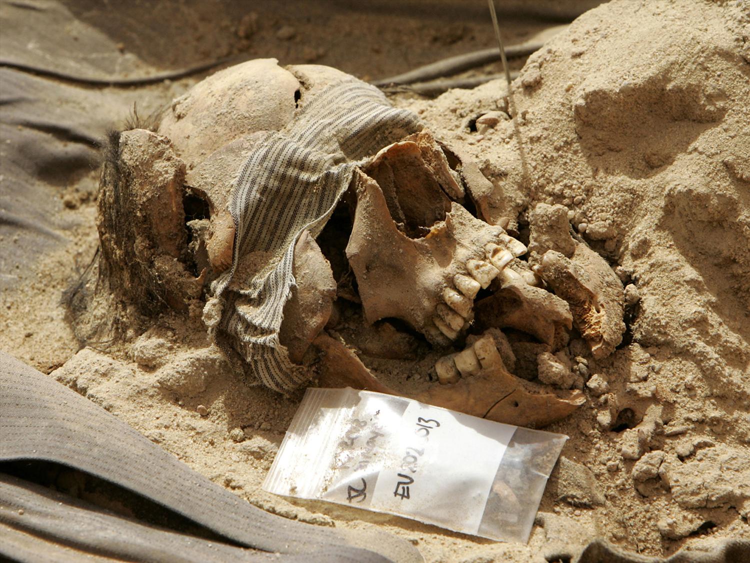 Human skull with blindfold lies next to a forensic tag