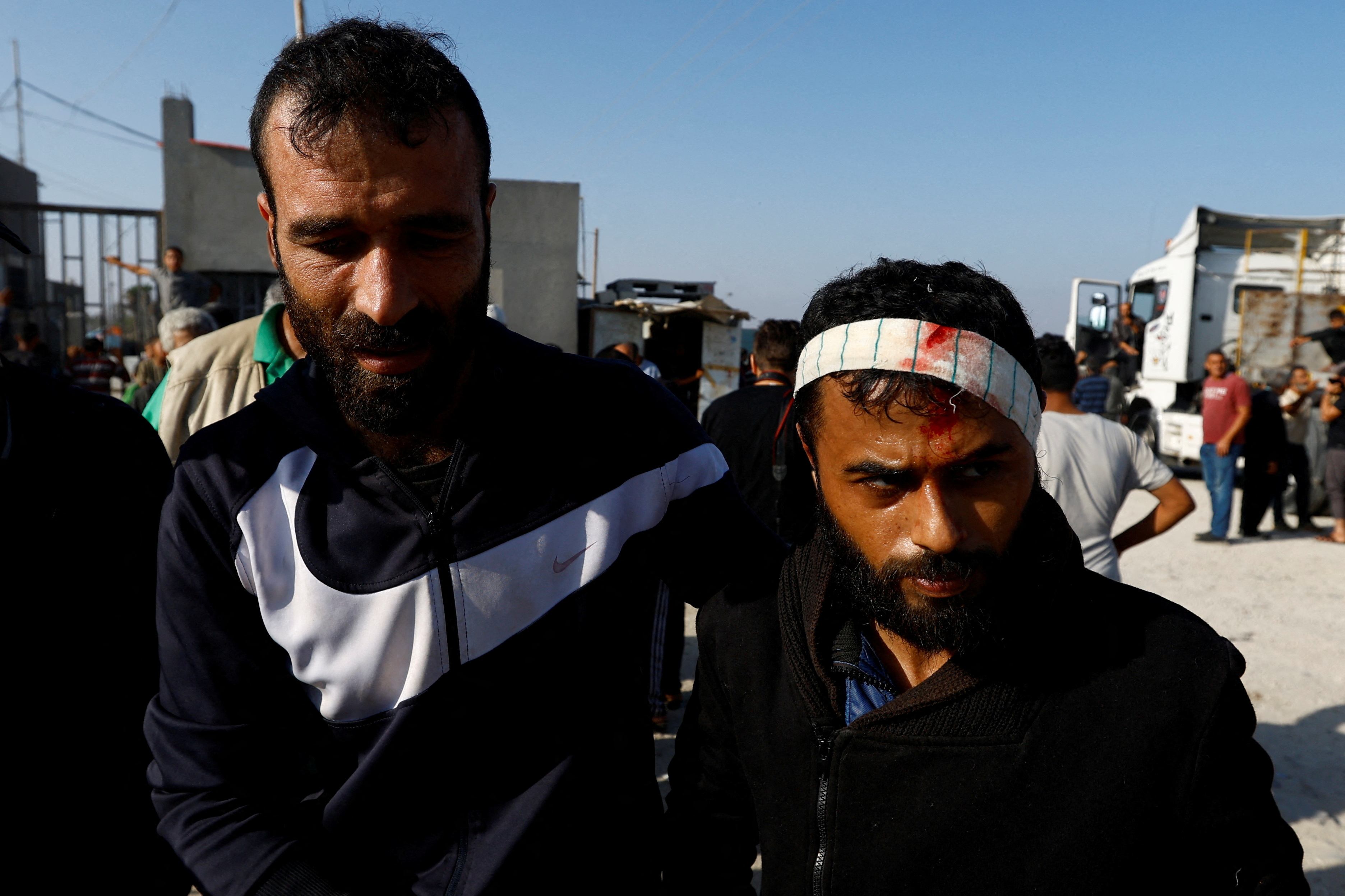 A Palestinian labourer Khaled al-Bahnasi, who was in Israel during the Hamas October 7 attack and said that he was beaten on his head by Israeli forces, is welcomed as he arrives at the Rafah border after being sent back by Israel to the Strip, in the southern Gaza Strip.