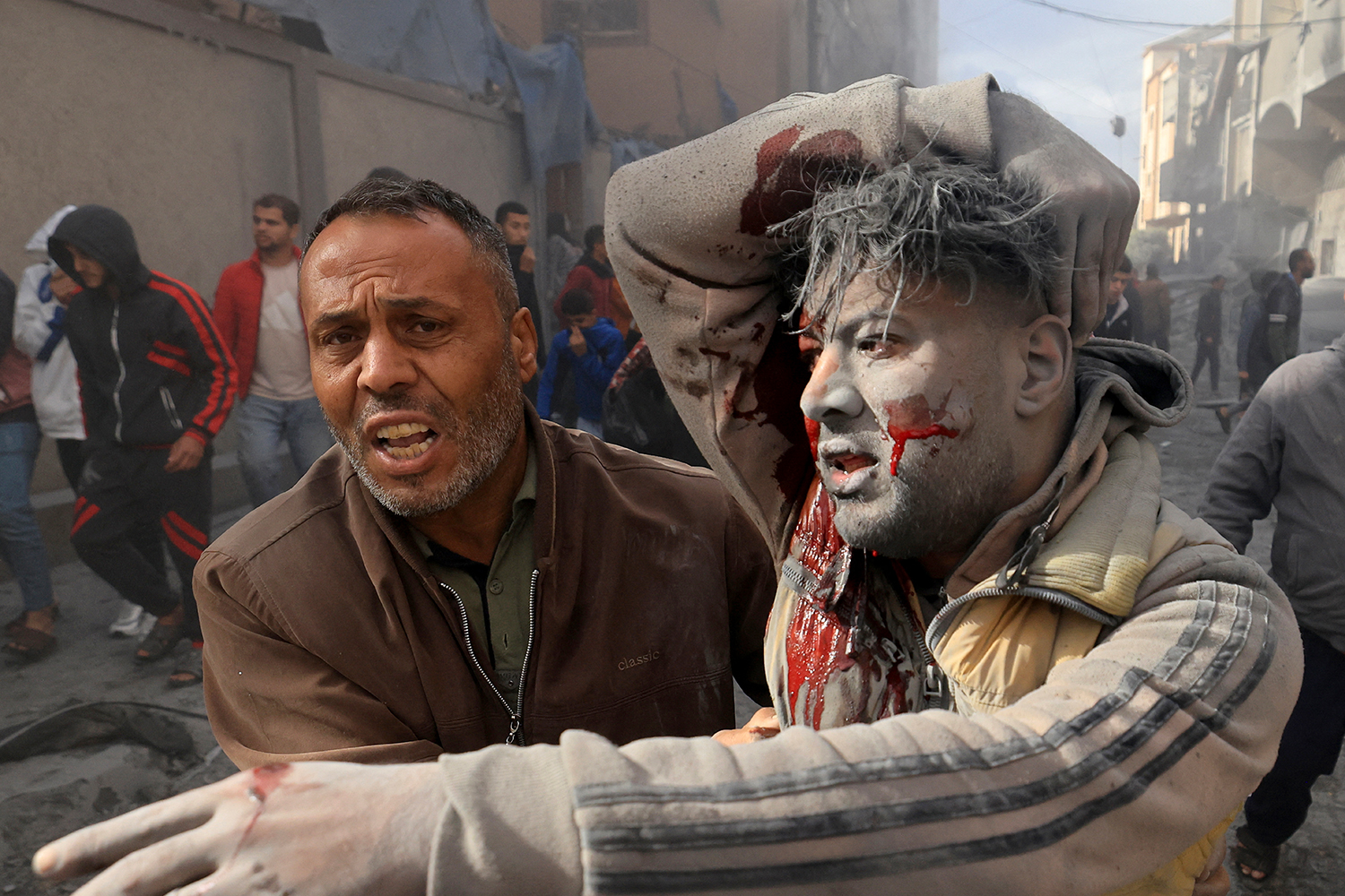 An injured Palestinian