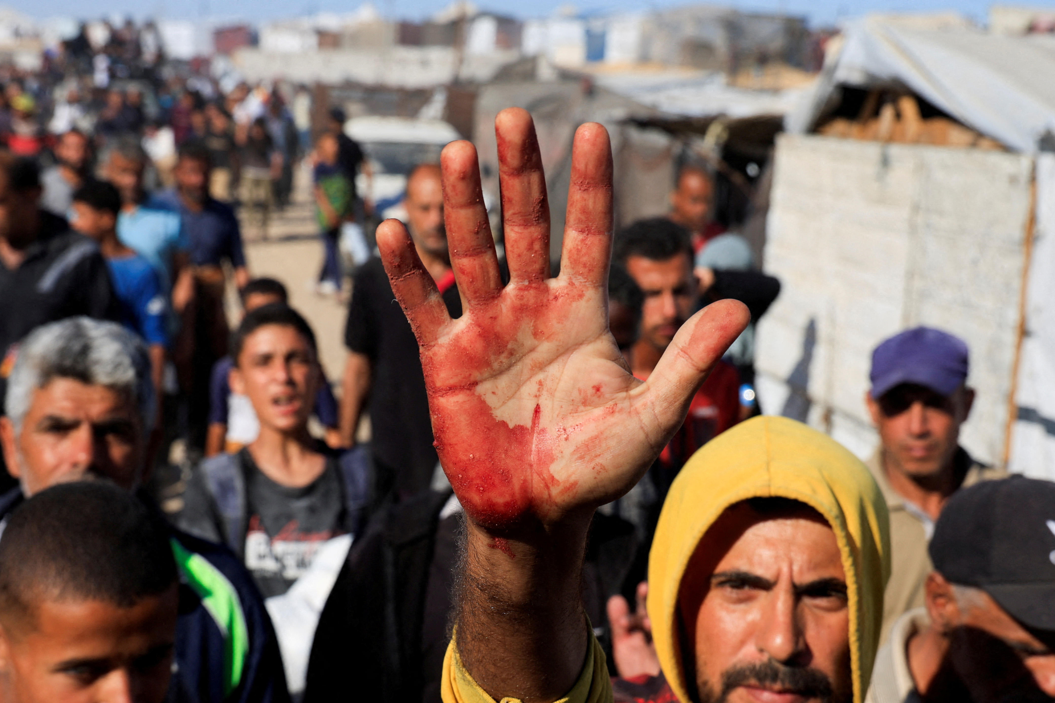 A Palestinian man shows blood stains on his palm after he carried casualties among people seeking aid supplies from the U.S.-backed Gaza Humanitarian Foundation, in Khan Younis, in the southern Gaza Strip, May 29, 2025.