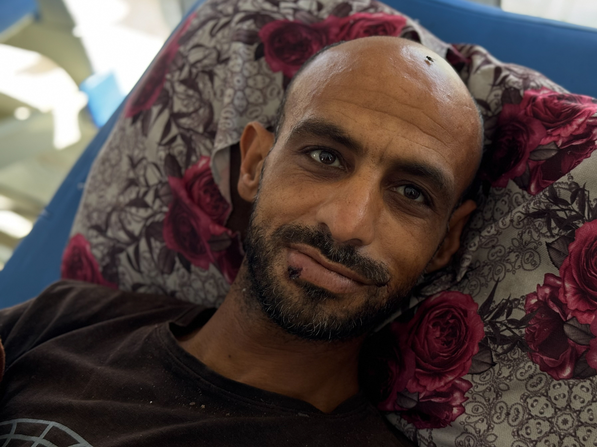 A thin, bald man with a gentle face lies in his hospital bed